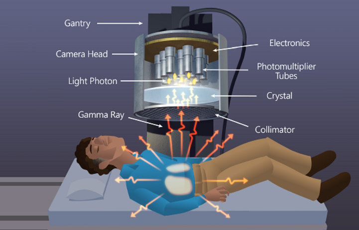 illustration of person receiving radiation